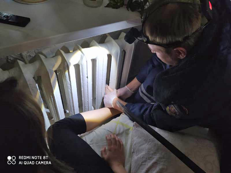 Спасатели ГКУ МО «Мособлпожспас» освободили ногу девочки, застрявшую в батарее