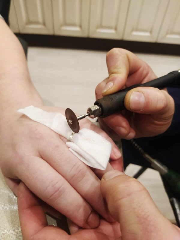 Спасатели ГКУ МО «Мособлпожспас» освободили палец беременной женщины от застрявшего кольца