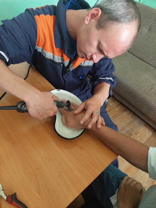 Работники ГКУ МО «Мособлпожспас» за сутки помогли двум жителям Балашихи снять кольца с пальцев